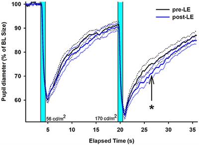 Can Extra Daytime Light Exposure Improve Well-Being and Sleep? A Pilot Study of Patients With Glaucoma